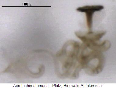 acrotrichis_atomaria_sperm.jpg