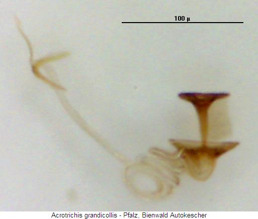 acrotrichis_grandicollis_sperm.jpg