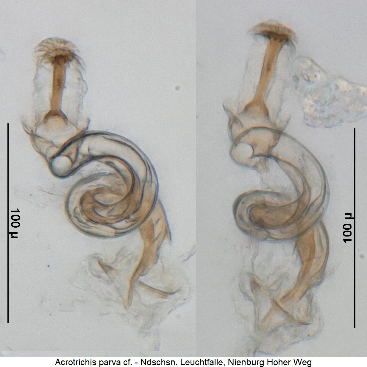 acrotrichis_parva_cf_sperm.jpg