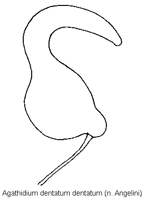 agathidium_dentatum_sperm.gif