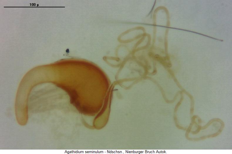 agathidium_seminulum_sperm.jpg