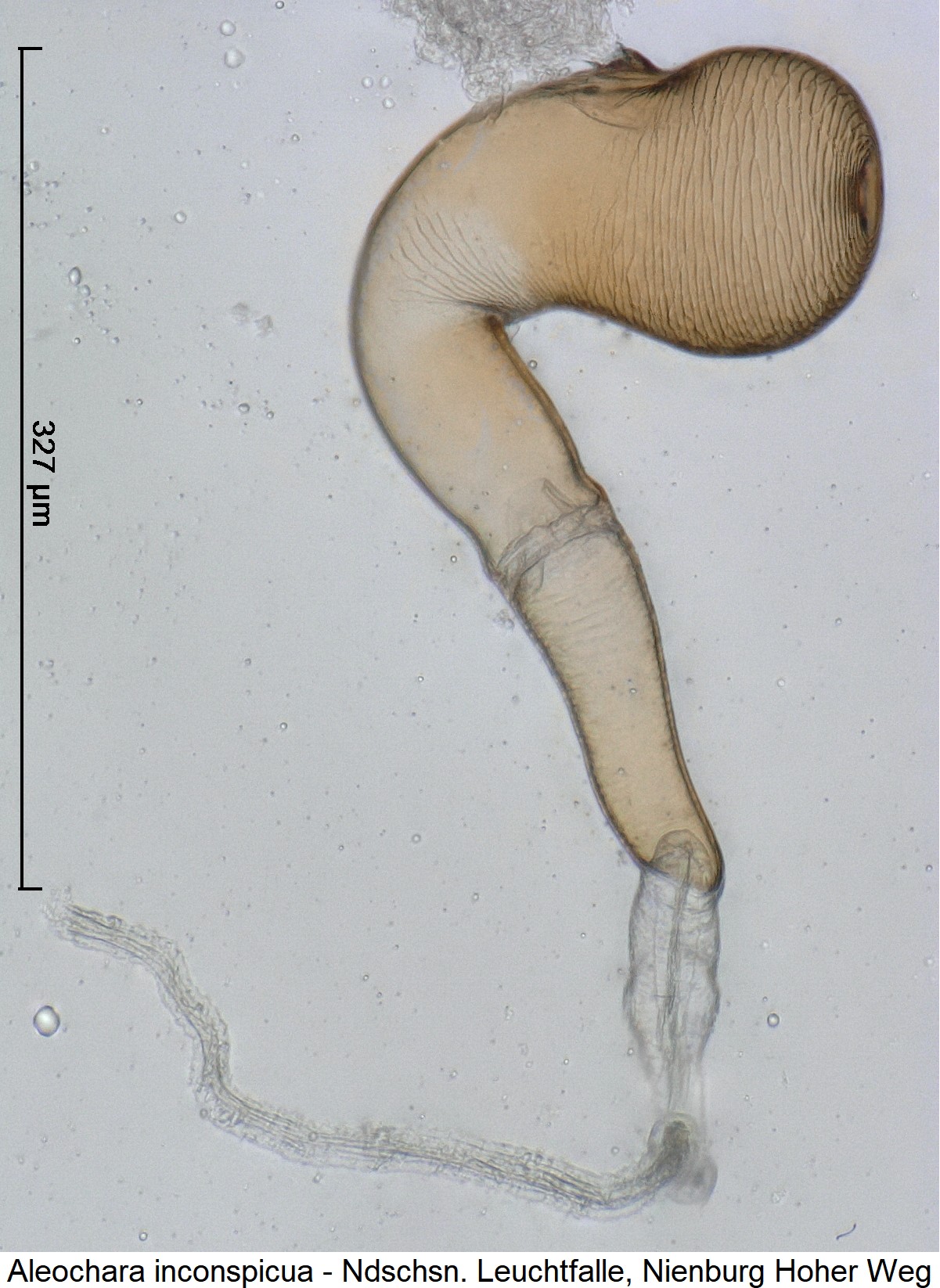 aleochara_inconspicua_ck36201122_sperm.jpg