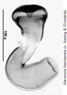alevonota_hierroensis_sperm.jpg