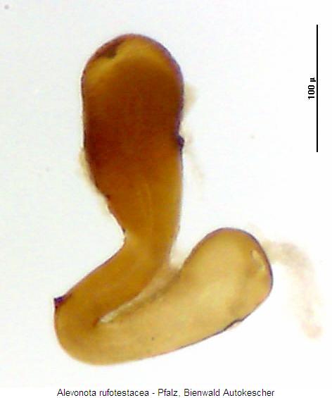 alevonota_rufotestacea_sperm2.jpg