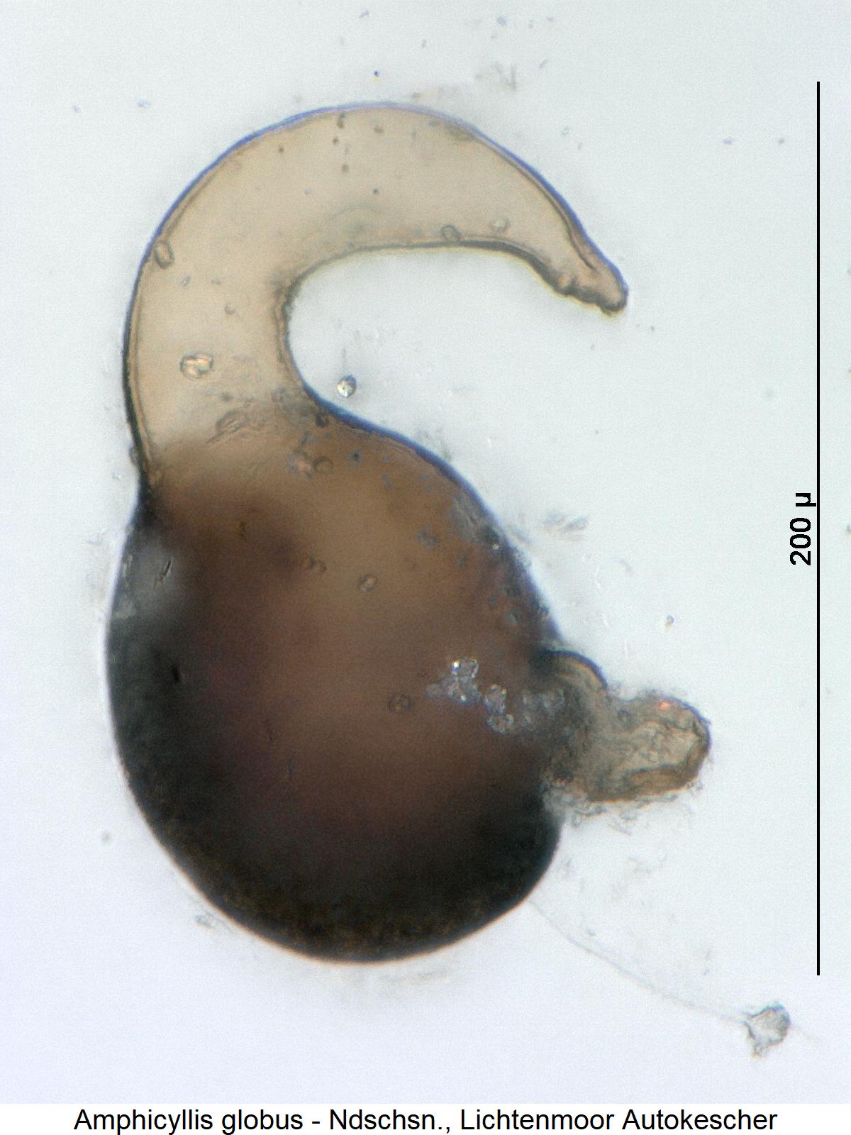 amphicyllis_globus_sperm.jpg