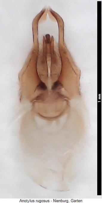 anotylus_rugosus.jpg