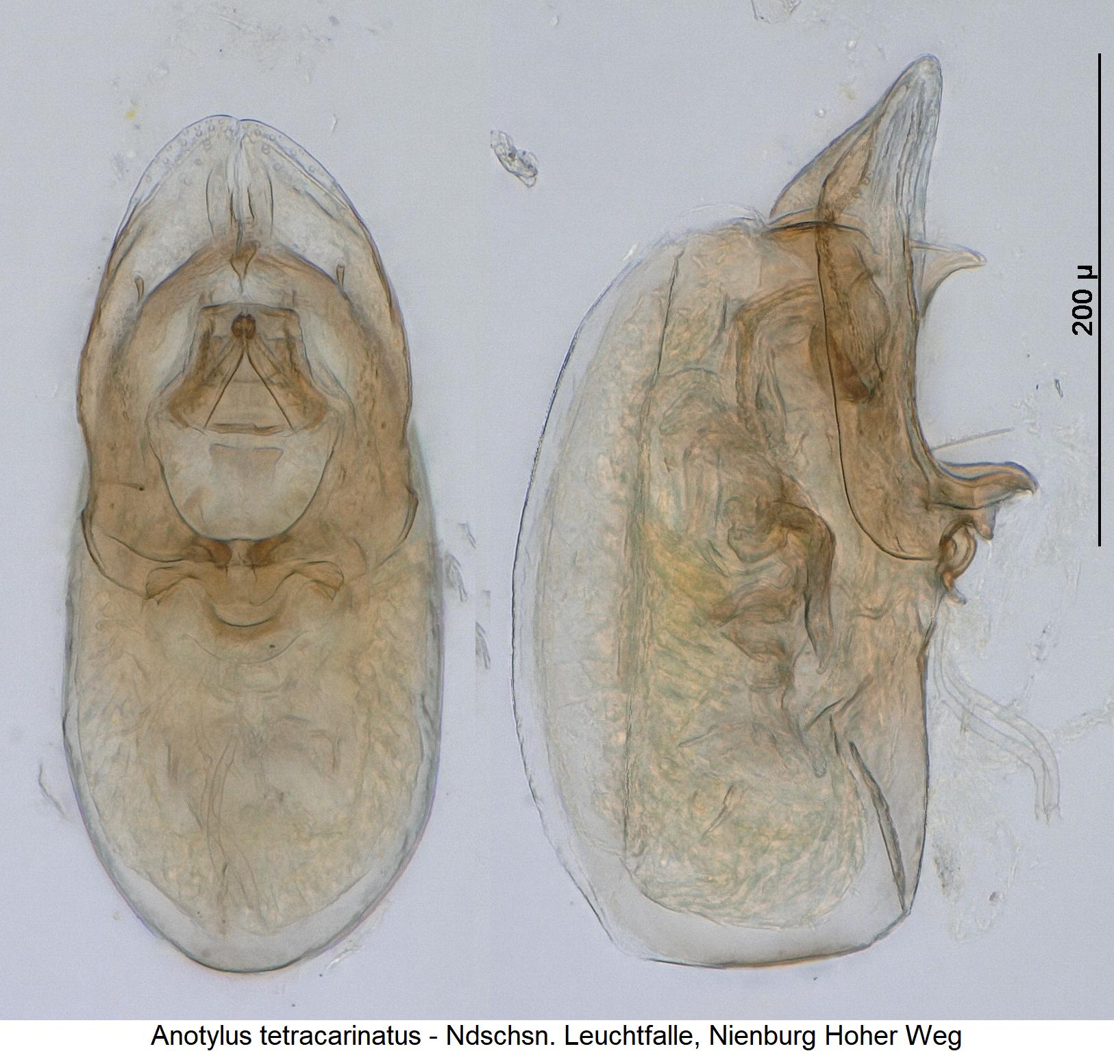 anotylus_tetracarinatus.jpg