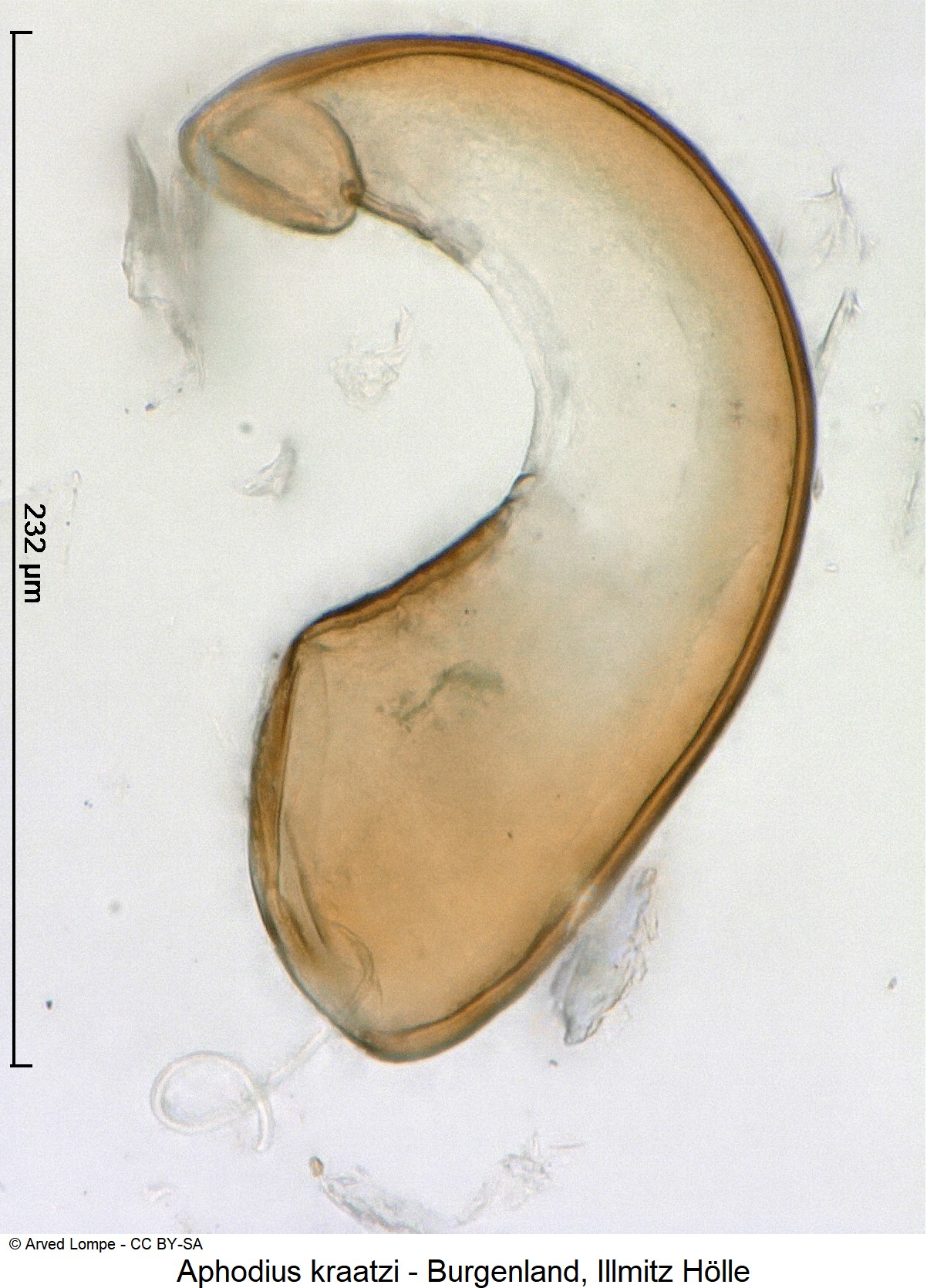 aphodius_kraatzi_ck33486220_sperm.jpg