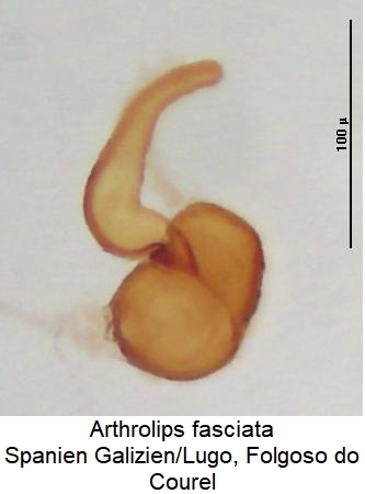 arthrolips_fasciata_sperm.jpg