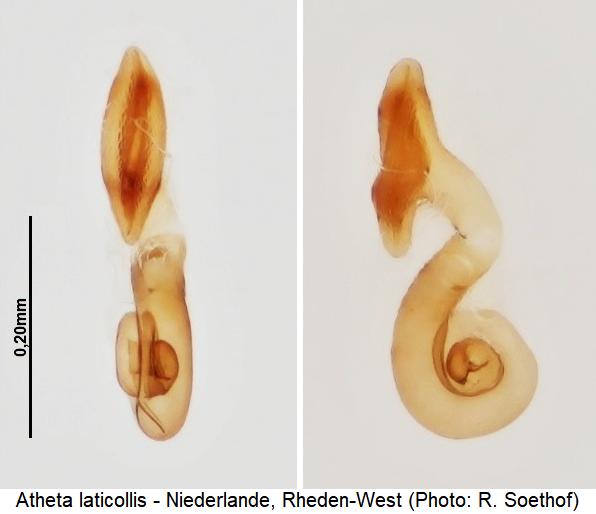 atheta_laticollis_sperm.jpg
