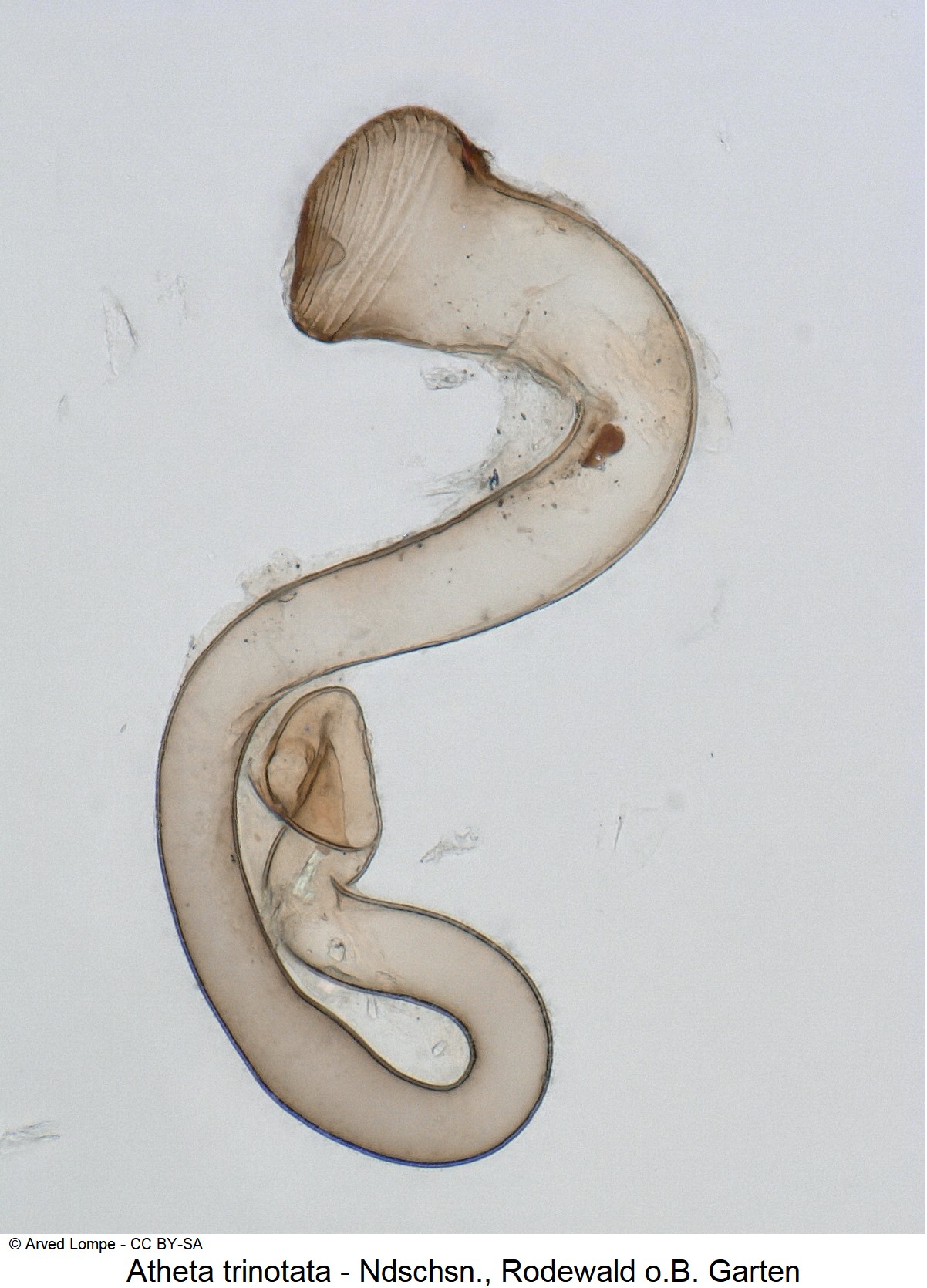 atheta_trinotata_ck37130349_sperm.jpg
