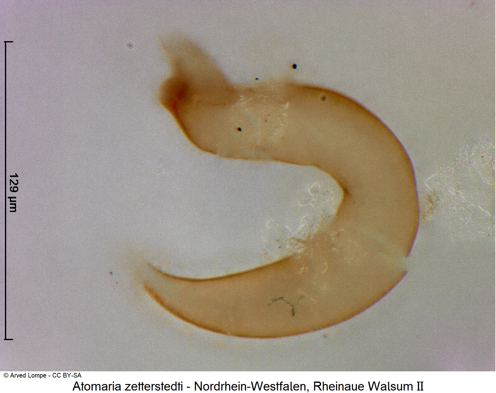 atomaria_zetterstedti_ck38099814_sperm.jpg