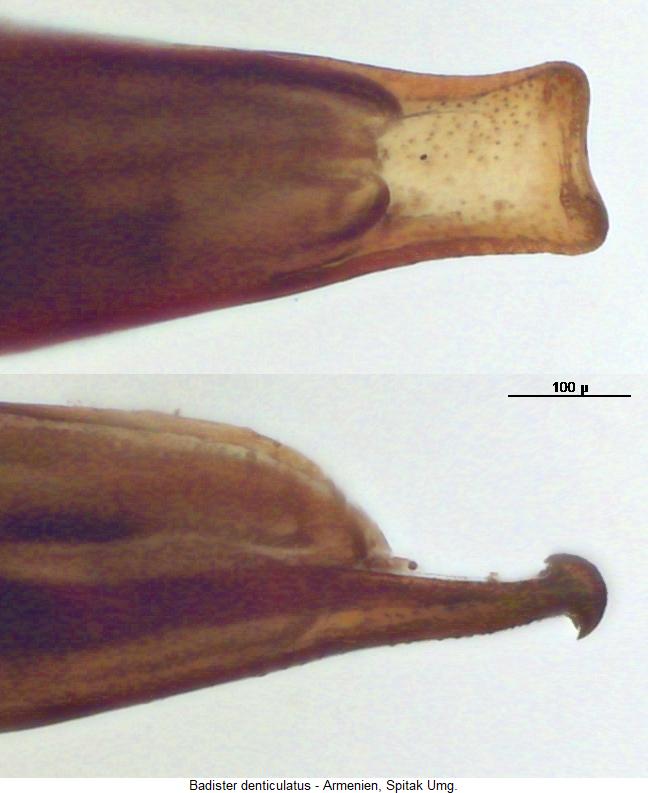 badister_denticulatus_detail.jpg