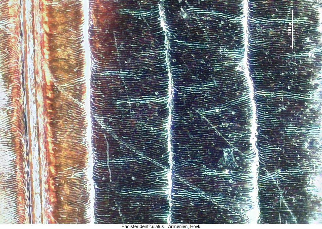 badister_denticulatus_ms.jpg
