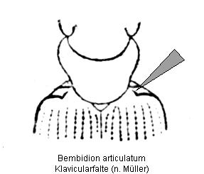 bemb6.jpg