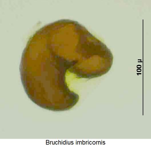 bruchidius_imbricornis_sperm.jpg