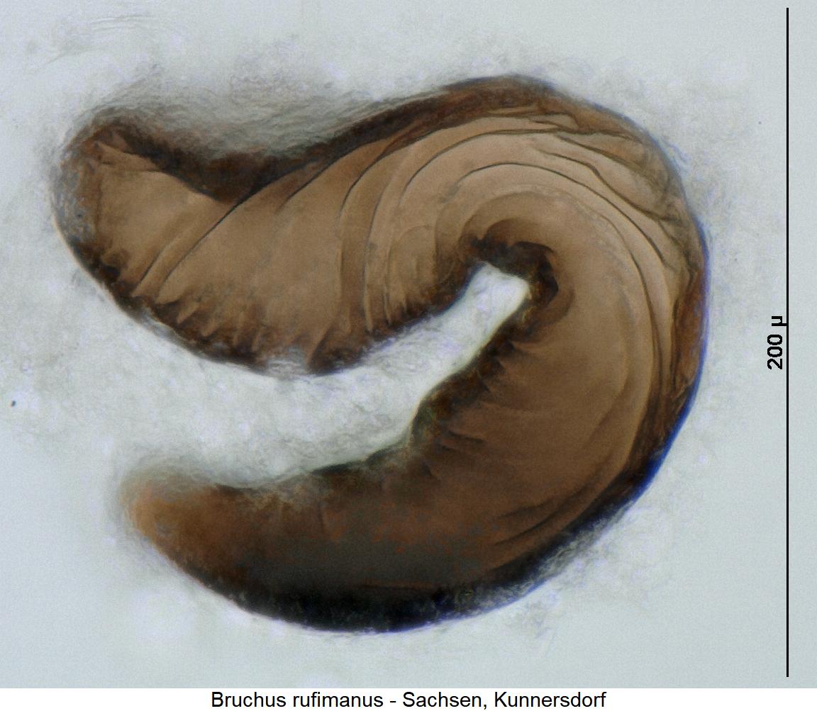 bruchus_rufimanus_sperm.jpg