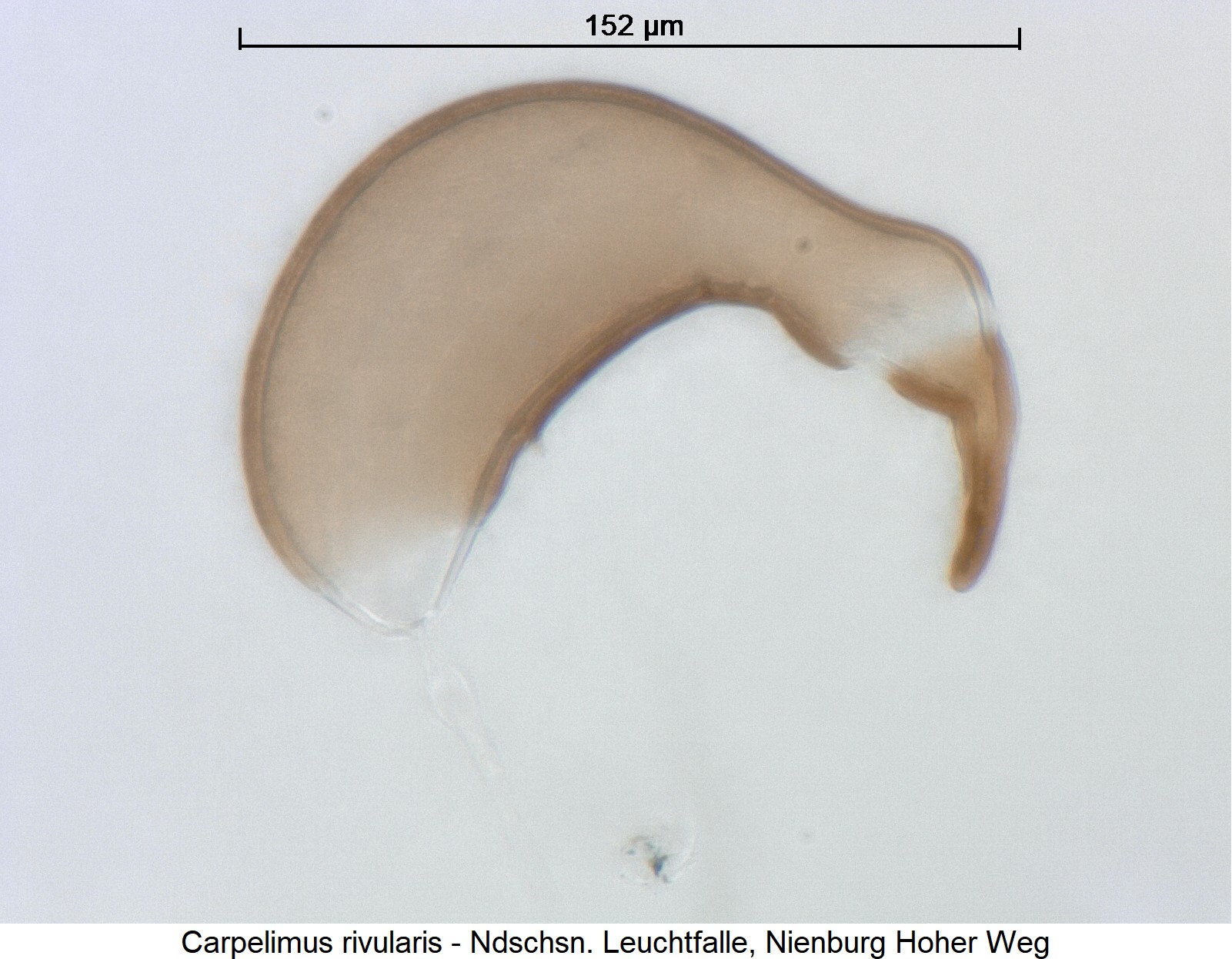 carpelimus_rivularis_ck36202597_sperm.jpg