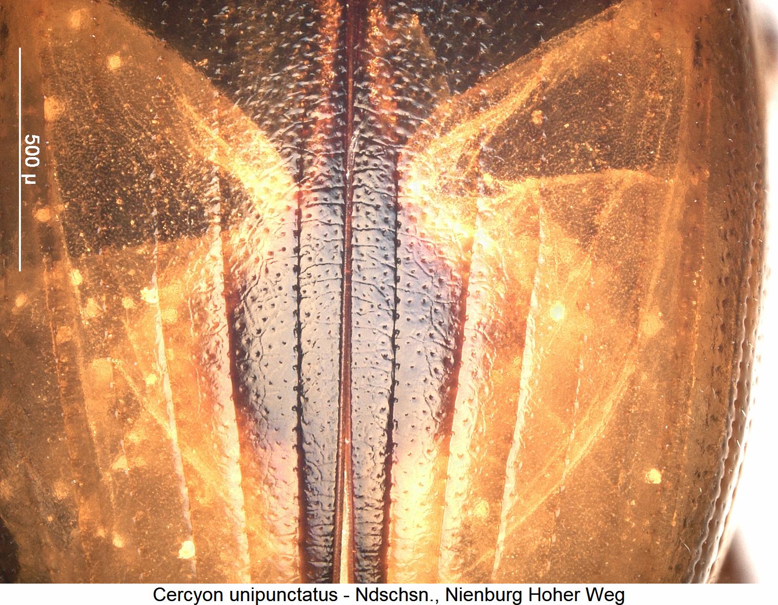 cercyon_unipunctatus_ms.jpg