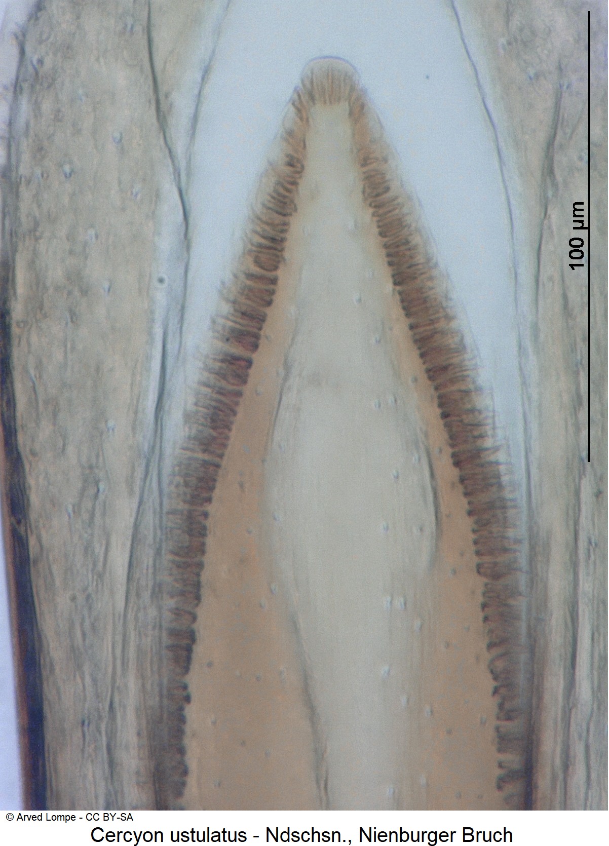 cercyon_ustulatus_ck35557655_detail.jpg