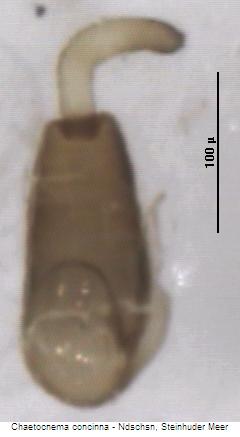 chaetocnema_concinna_sperm.jpg