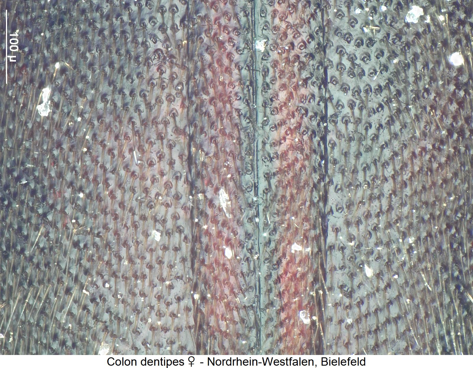 colon_dentipes_w_fld_ms.jpg