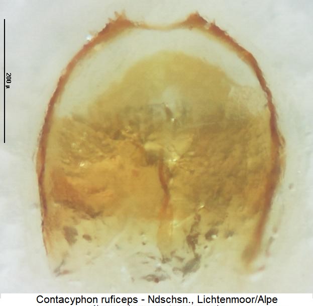 contacyphon_ruficeps_sperm.jpg