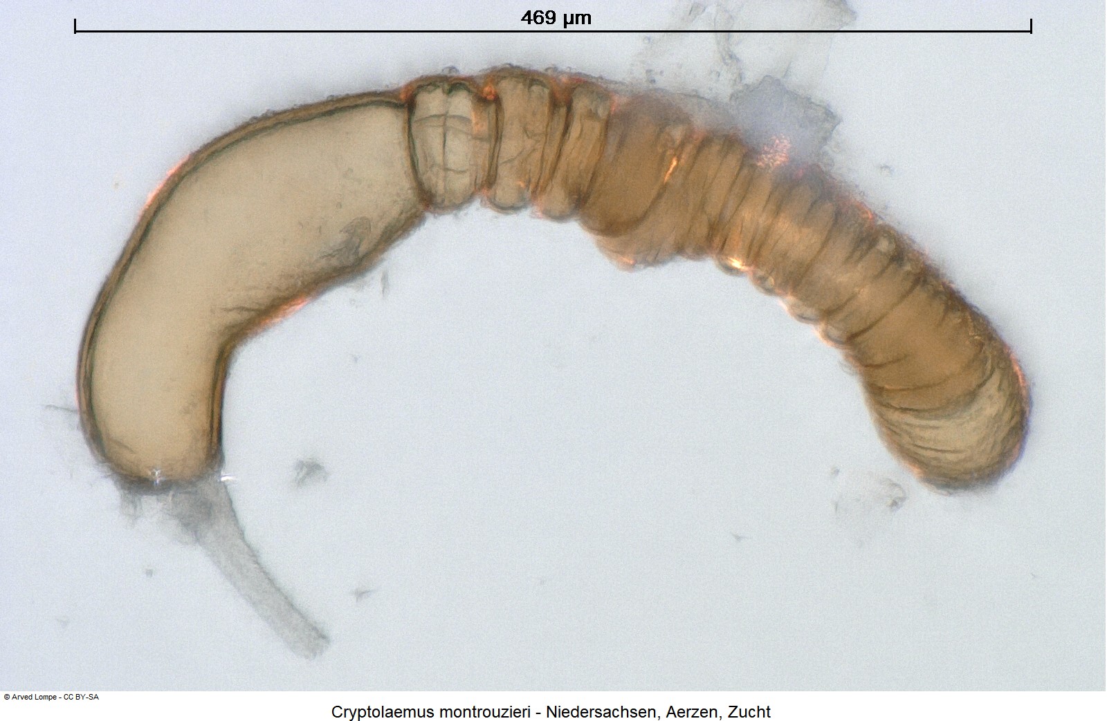 cryptolaemus_montrouzieri_ck35440007_sperm.jpg
