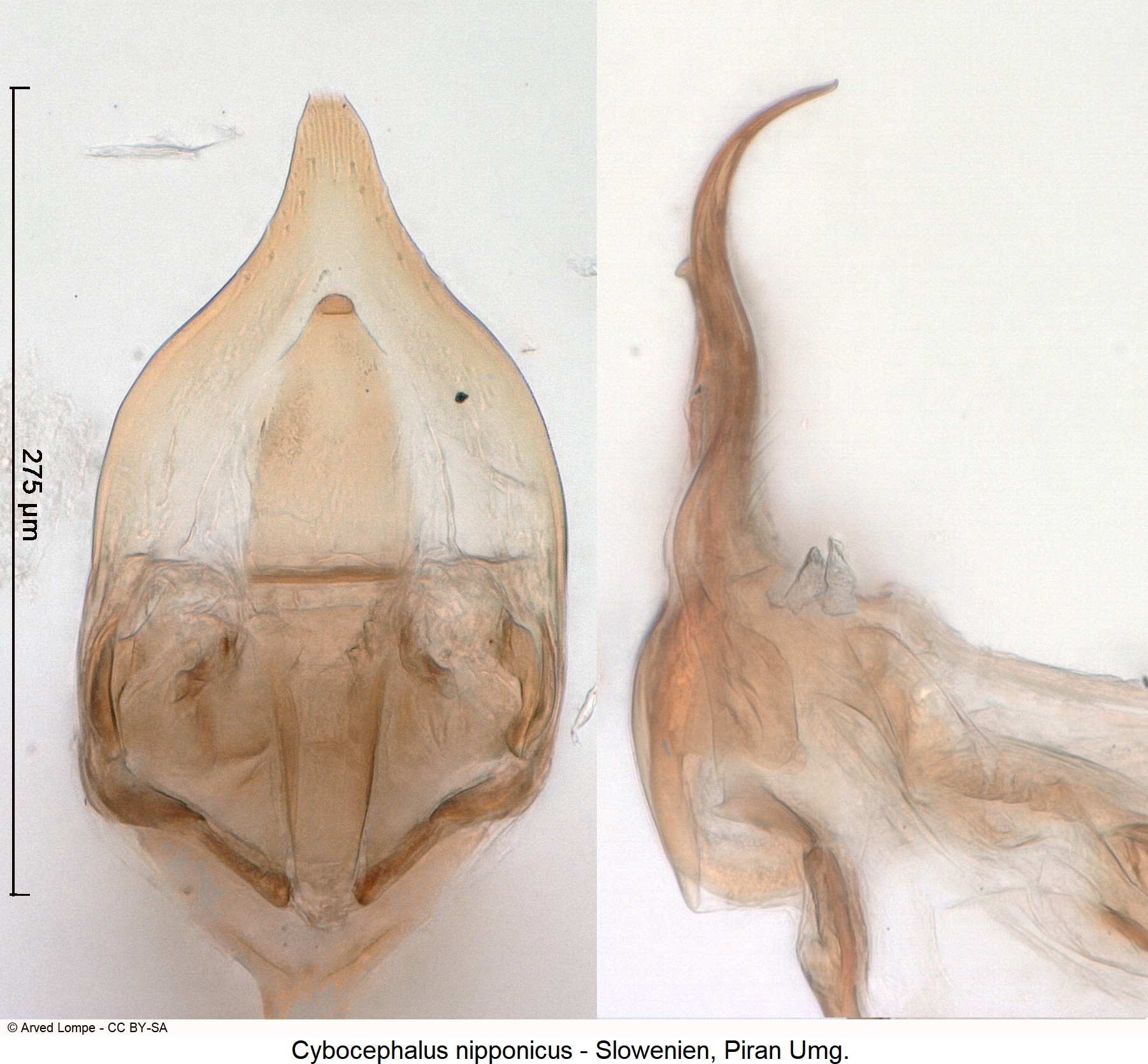 cybocephalus_nipponicus_jpg.jpg