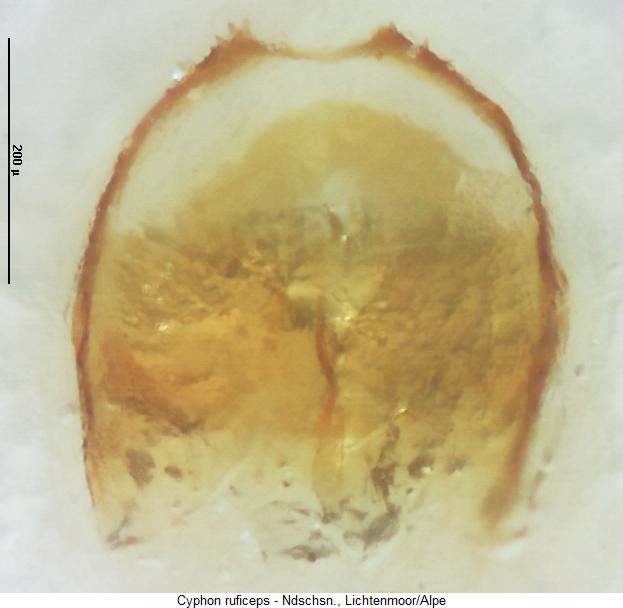 cyphon_ruficeps_sperm.jpg