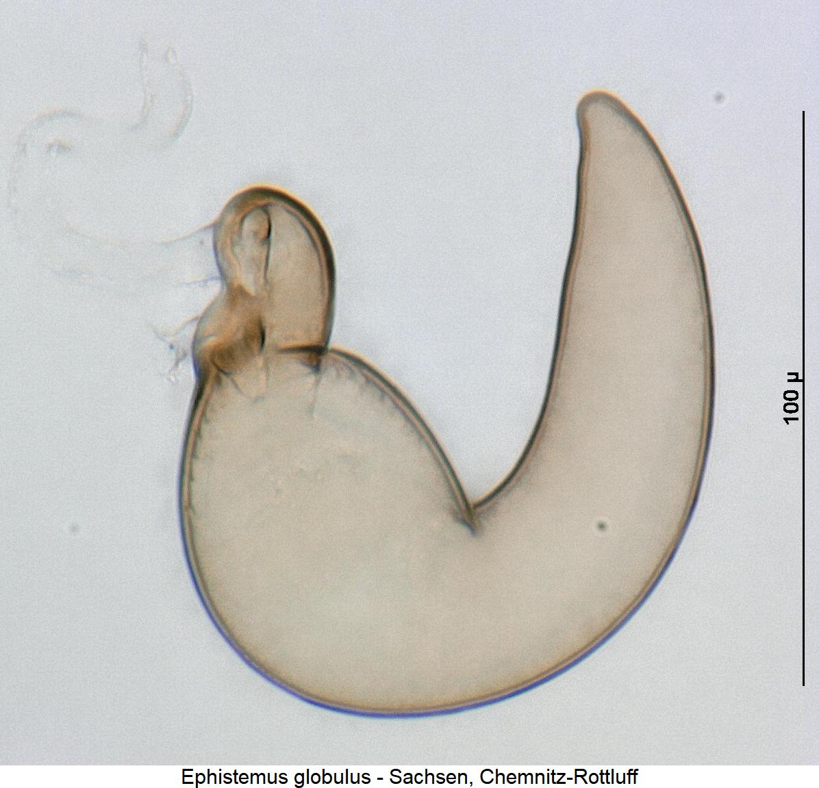 ephistemus_globulus_sperm.jpg