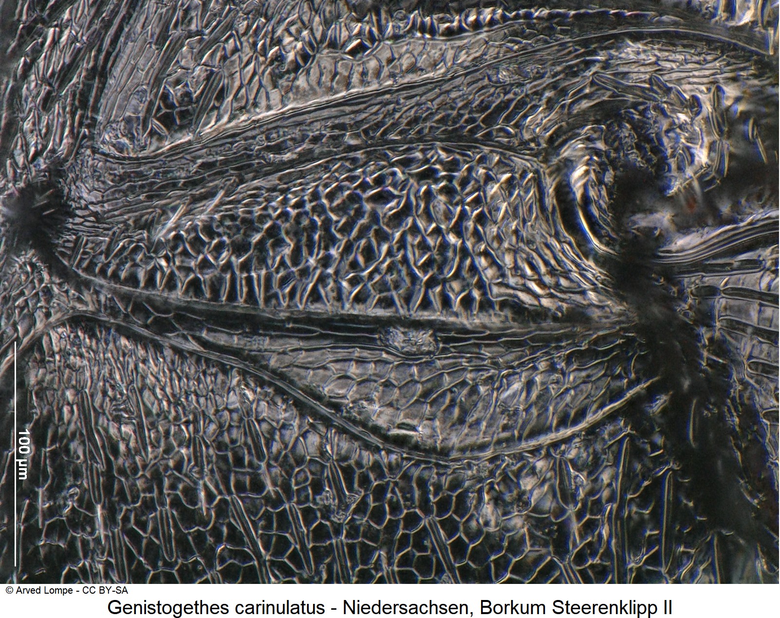 genistogethes_carinulatus_ck33132731_hinterhueften.jpg