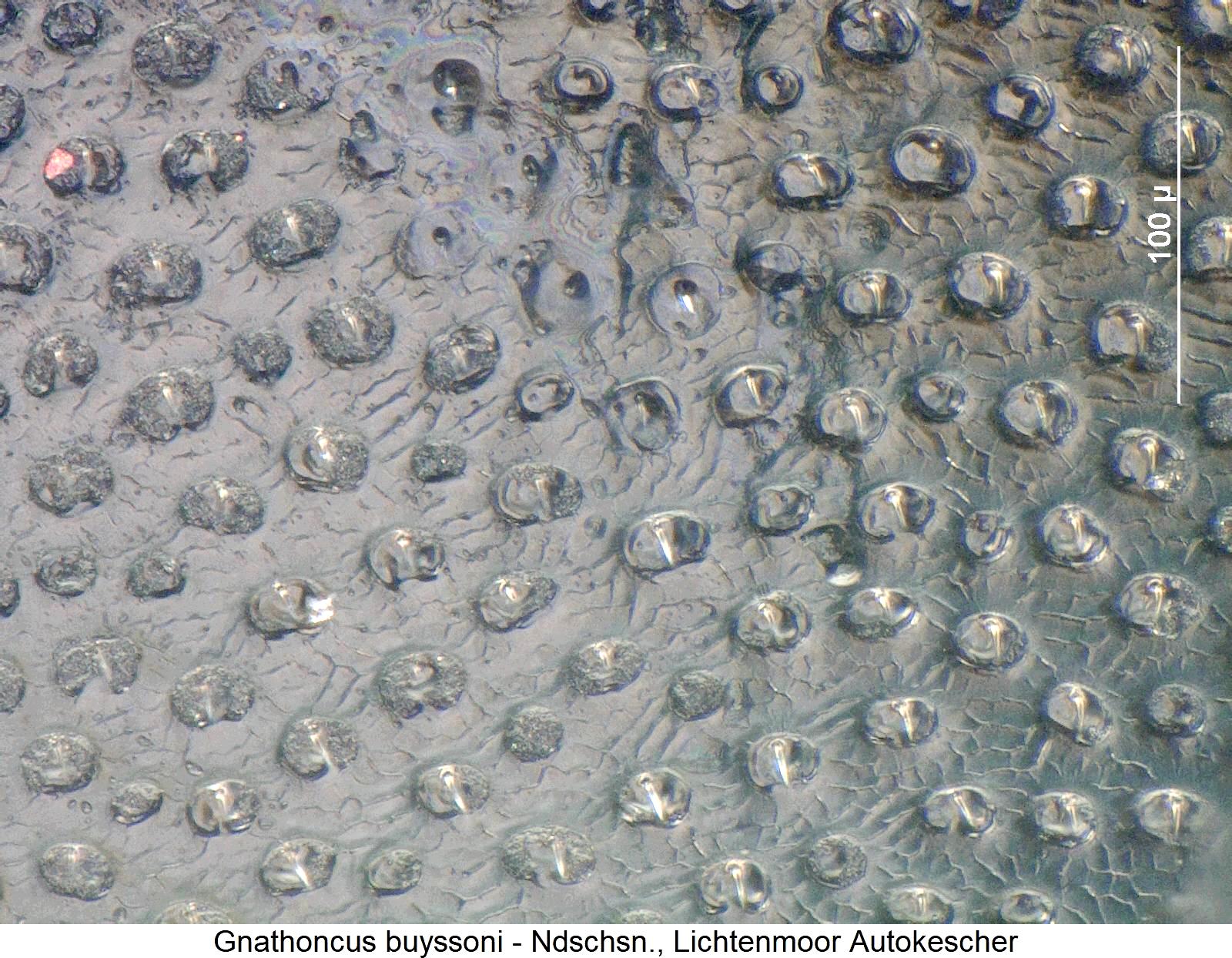 gnathoncus_buyssoni_pyg1.jpg