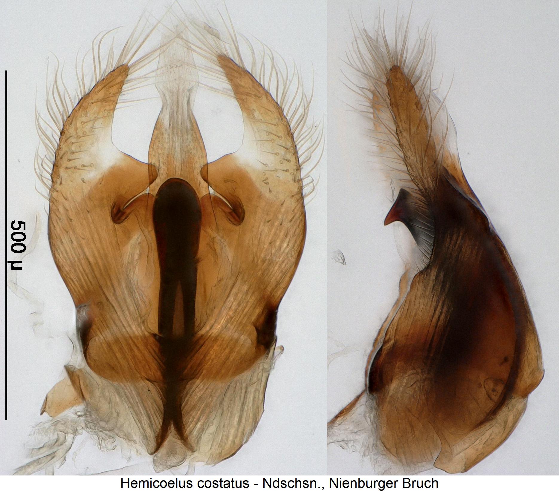 hemicoelus_costatus.jpg