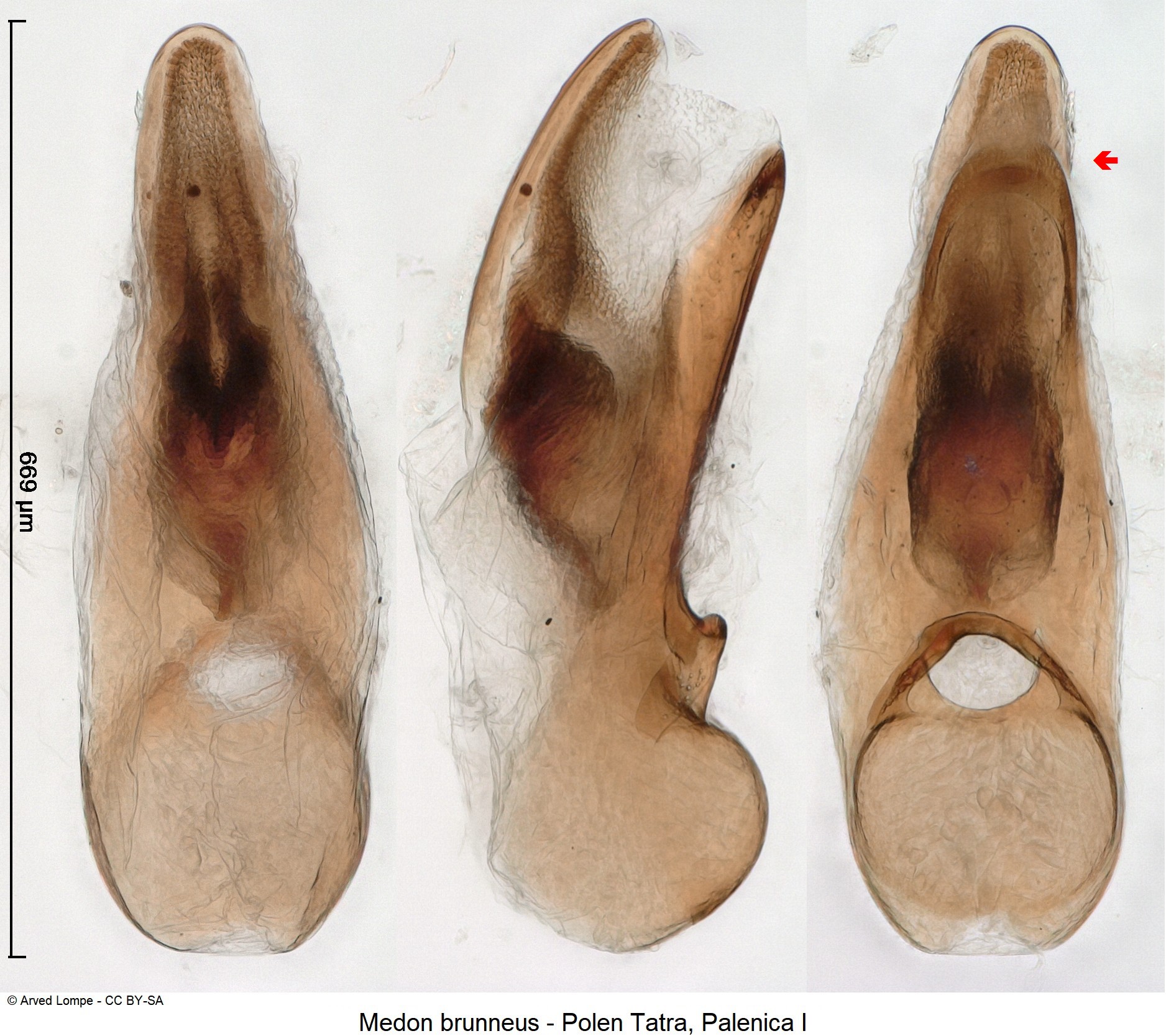 medon_brunneus_ck34541784.jpg