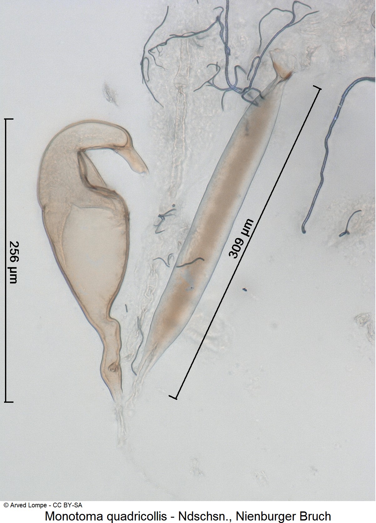 monotoma_quadricollis_ck35742064_sperm.jpg
