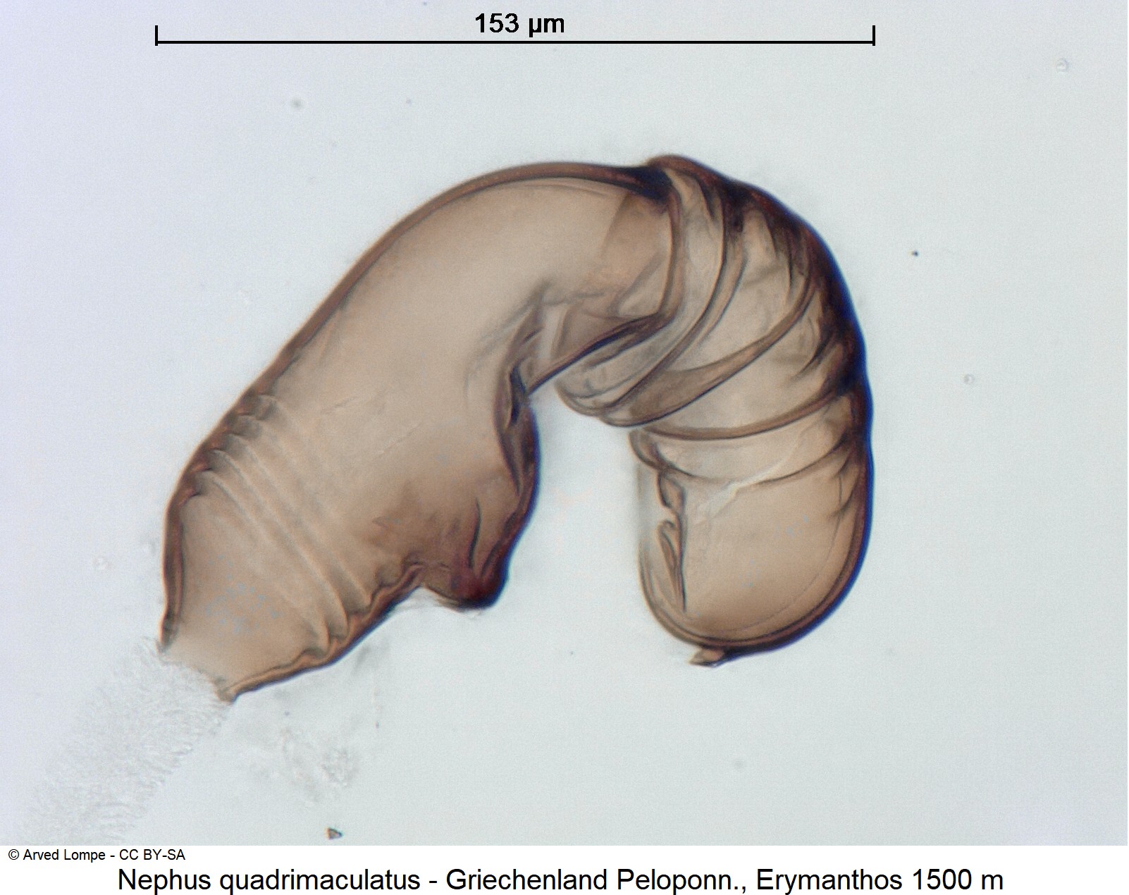nephus_quadrimaculatus_ck37295339_sperm.jpg