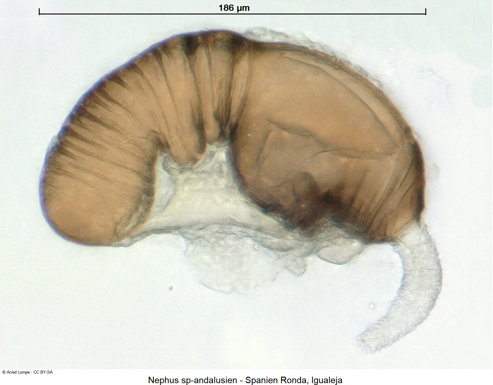 nephus_sp-andalusien_sperm.jpg