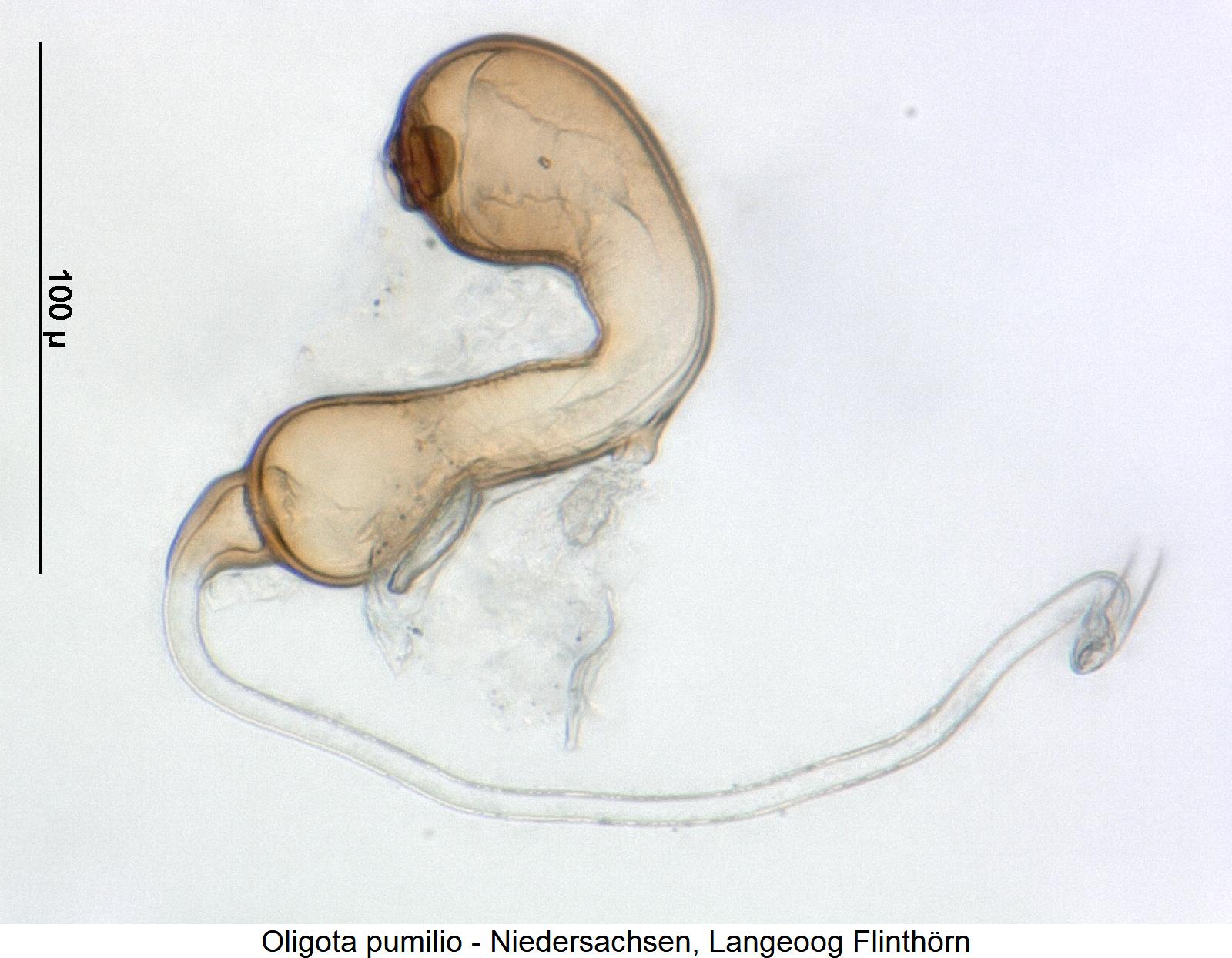 oligota_pumilio_sperm.jpg