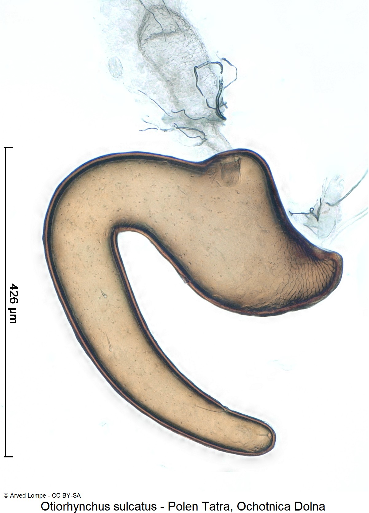 otiorhynchus_sulcatus_ck32743480_sperm.jpg