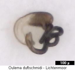 oulema_duftschmidi_sperm.jpg