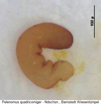 pelenomus_quadricorniger_sperm.jpg