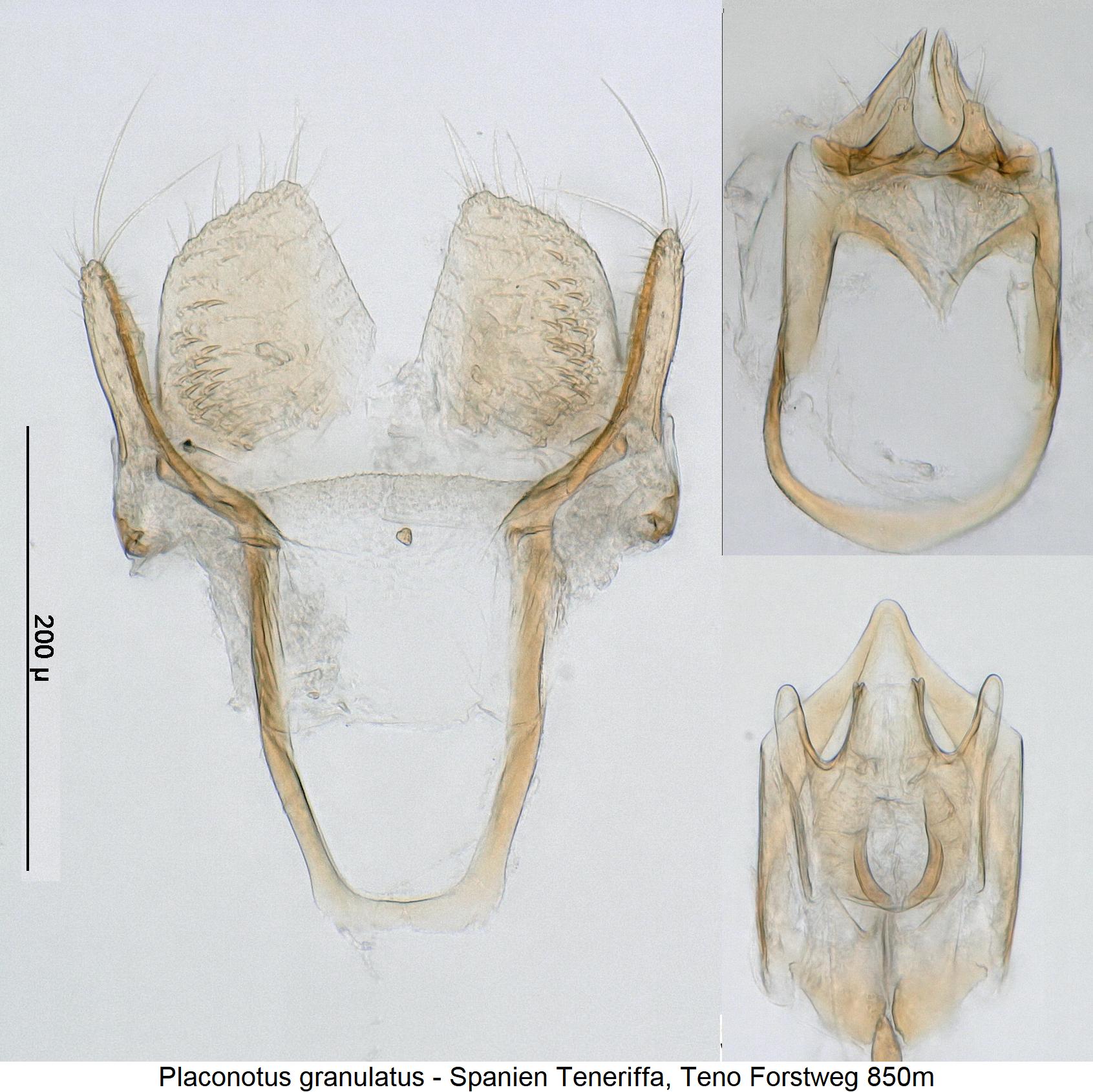 placonotus_granulatus_details.jpg