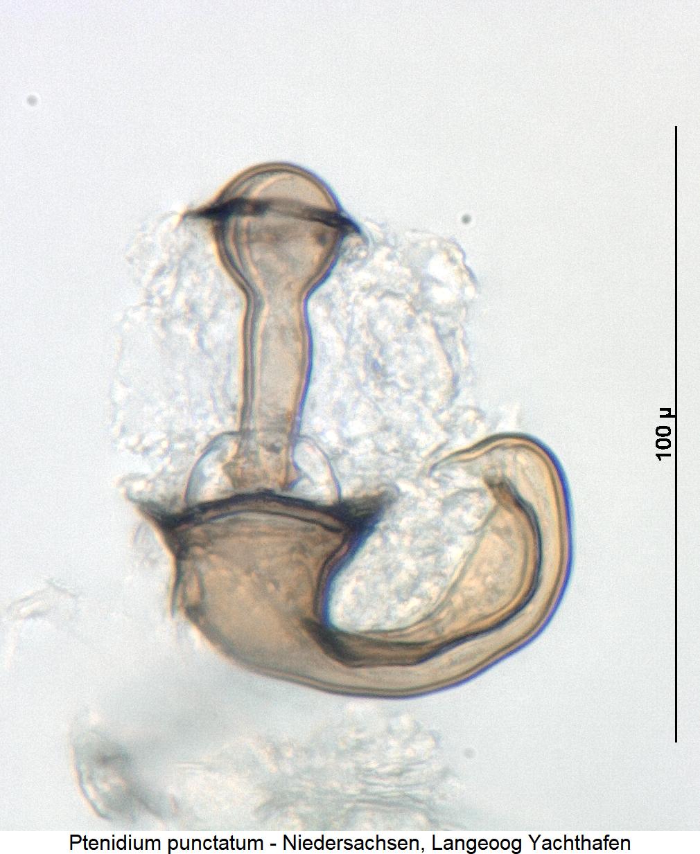 ptenidium_punctatum_sperm.jpg