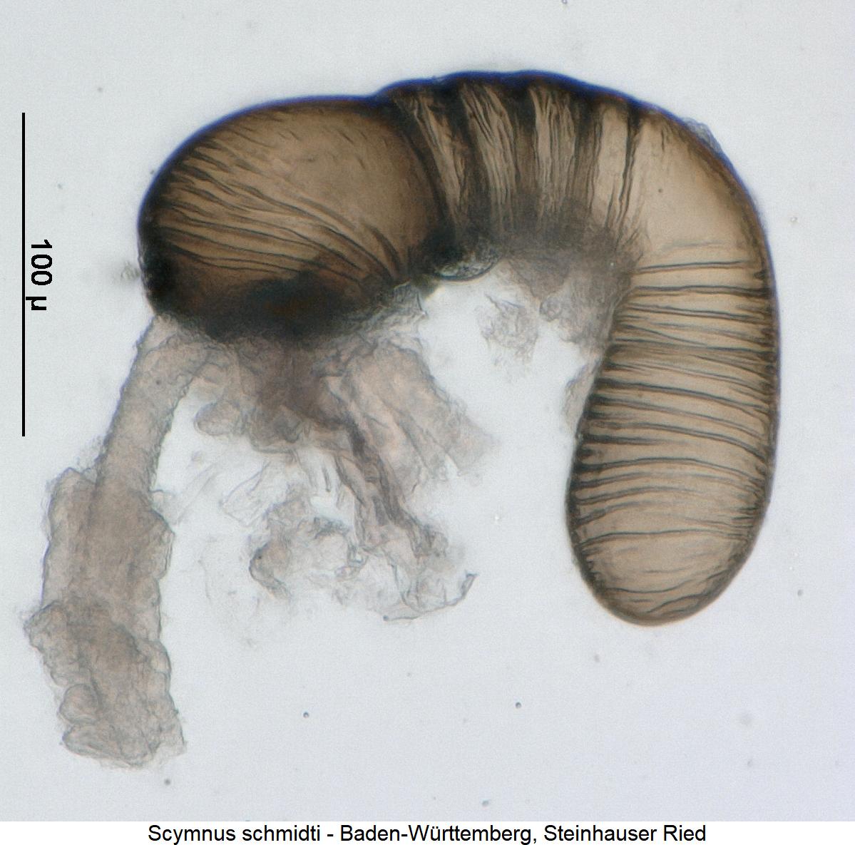 scymnus_schmidti_sperm.jpg