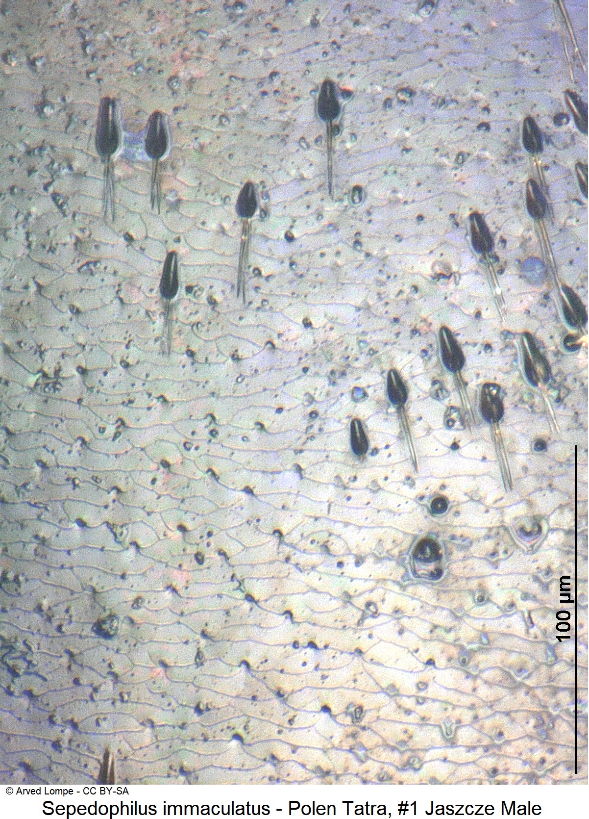 sepedophilus_immaculatus_nr1_ck34584025_hsch_ms-1.jpg