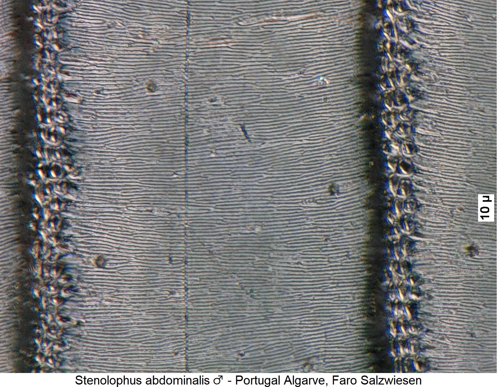 stenolophus_abdominalis_m_fld_ms.jpg