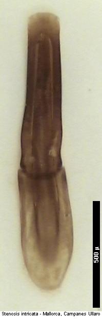 stenosis_intricata.jpg