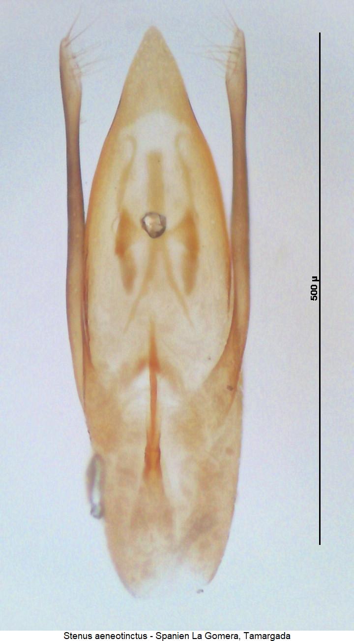 stenus_aeneotinctus1.jpg