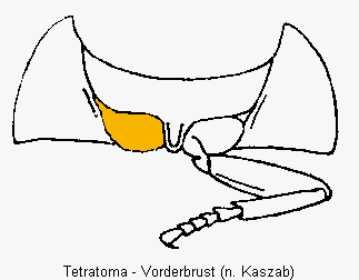 tetratoma_vbr.gif